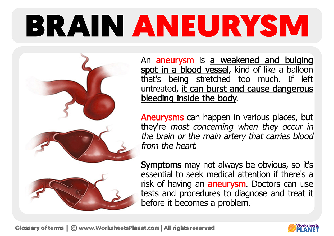 What Is A Brain Aneurysm