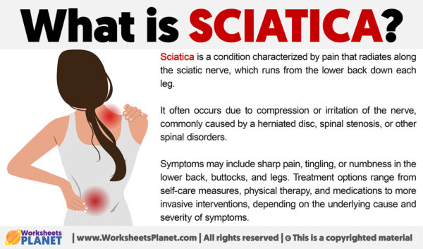 What is Sciatica | Definition of Sciatica