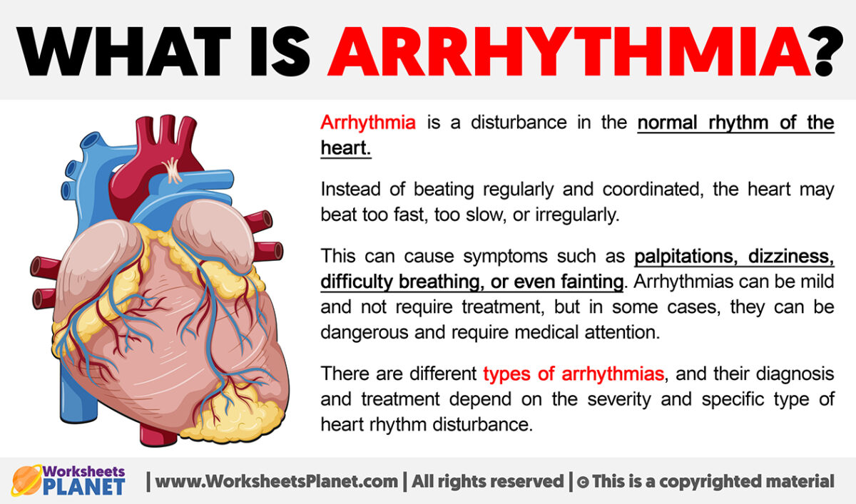 What is Arrhythmia | Definition of Arrhythmia