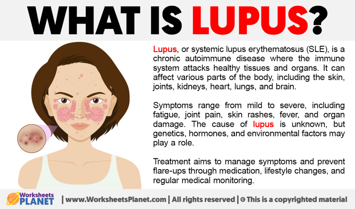 What Is Lupus Definition Of Lupus   What Is Lupus 1200x707 